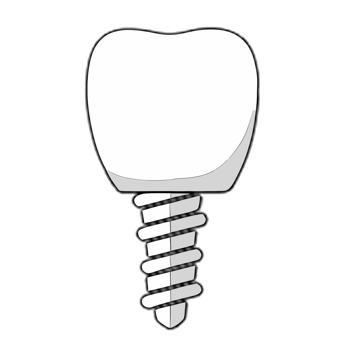 Dental Implants 專業植牙耗材批發｜適配奧齒泰、士卓曼、登騰｜現貨發台灣